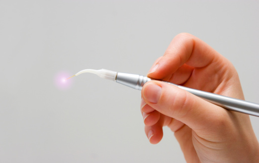 LANAP laser tool