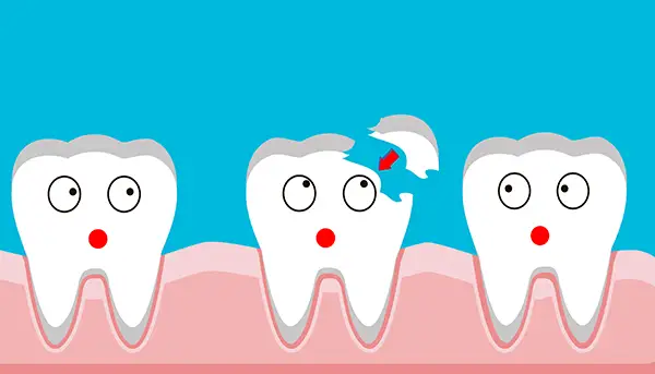 Three cartoon teeth with faces in a row, with one tooth breaking and a red arrow showing the chipped fragment.